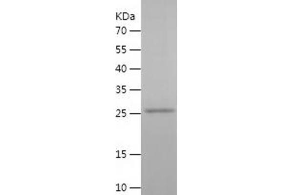 PGD Protein (AA 33-259) (His tag)