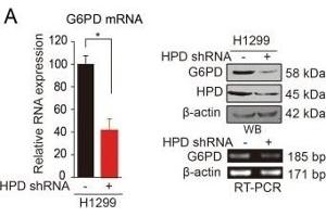 HPD contributes to cell proliferation through upregulation of G6PD. (HPD Antikörper)