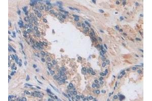 Immunohistochemistry (IHC) image for anti-Arrestin, beta 1 (ARRB1) (AA 3-246) antibody (ABIN7441790)