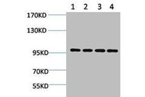 Western blot analysis of 1) Hela, 2) 293T, 3) 3T3, 4) Rat Brain using ERK 3 Polyclonal Antibody. (MAPK6 Antikörper)