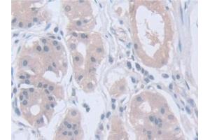 Immunohistochemistry (IHC) image for anti-Calpain, Small Subunit 1 (CAPNS1) (AA 1-268) antibody (ABIN7441262)