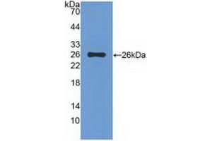Detection of Recombinant TIGIT, Rat using Polyclonal Antibody to T-Cell Immunoreceptor With Ig And ITIM Domains Protein (TIGIT) (TIGIT Antikörper  (AA 28-227))
