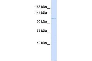 PTCH2 antibody used at 1 ug/ml to detect target protein. (Patched 2 Antikörper)