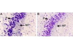 Expression of NGF in rat brain - Immunohistochemical staining of rat hippocampal mossy fiber terminal zone using Anti-NGF Antibody (#AN-240). (Nerve Growth Factor Antikörper  (Intracellular))