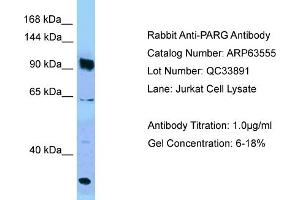 Western Blotting (WB) image for anti-PARG (PARG) (C-Term) antibody (ABIN2789543) (PARG Antikörper  (C-Term))