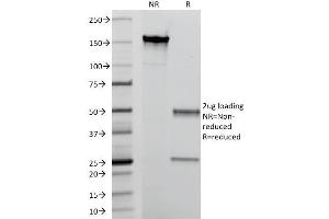SDS-PAGE Analysis Purified Macrophage L1 Protein Mouse Monoclonal Antibody (MAC387). (S100A8 Antikörper)
