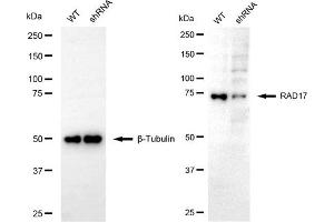 Western blotting analysis using RAD17 antibody (ABIN7800114).