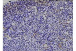 ABIN6269174 at 1/100 staining Human spleen tissue by IHC-P.