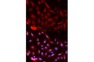 Immunofluorescence (IF) image for anti-Proteasome (Prosome, Macropain) Activator Subunit 1 (PA28 Alpha) (PSME1) antibody (ABIN1876546) (PSME1 Antikörper)