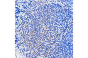Immunohistochemistry (IHC) image for anti-RNA Binding Motif Protein 39 (RBM39) (C-Term) antibody (ABIN7270085)