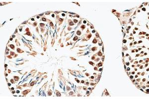 Immunohistochemistry of paraffin-embedded Mouse testis using CBX6 Polyclonal Antibody at dilution of 1:100 (40x lens). (CBX6 Antikörper)