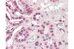 Anti-PIAS2 antibody IHC of human kidney. (PIAS2 Antikörper  (AA 431-445))