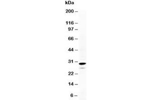 Western blot testing of Calretinin antibody and HeLa cell lysate. (Calretinin Antikörper  (N-Term))