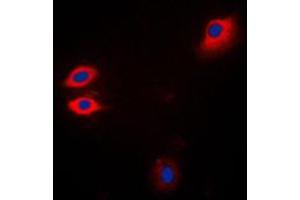 Immunofluorescent analysis of JAK1 staining in Jurkat cells. (JAK1 Antikörper  (C-Term))