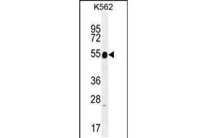 Western blot analysis in K562 cell line lysates (35ug/lane). (Keratin 25 Antikörper  (C-Term))