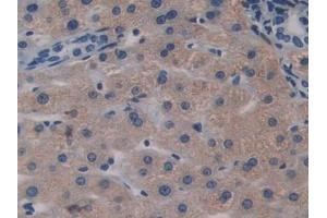 DAB staining on IHC-P; Samples: Human Liver Tissue (Biglycan Antikörper  (AA 230-366))