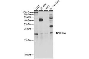 Western blot analysis of extracts of various cell lines, using R antibody (ABIN6131585, ABIN6146704, ABIN6146705 and ABIN6222716) at 1:1000 dilution.