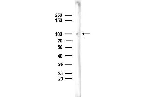 anti-Fucokinase (FUK) (N-Term) antibody