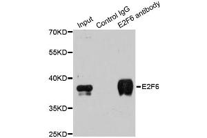 Immunoprecipitation analysis of 200ug extracts of MCF-7 cells using 3ug E2F6 antibody.