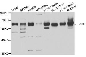 Western blot analysis of extracts of various cell lines, using KPNA5 antibody (ABIN4904175) at 1:1000 dilution. (KPNA5 Antikörper)