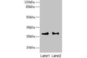 Western blot All lanes: HACD2 antibody at 4 μg/mL Lane 1: MCF-7 whole cell lysate Lane 2: LO2 whole cell lysate Secondary Goat polyclonal to rabbit IgG at 1/10000 dilution Predicted band size: 29 kDa Observed band size: 29 kDa (PTPLB Antikörper  (AA 7-41))