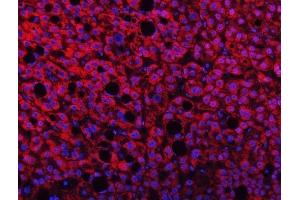 IF analysis of TMPRSS13 using anti-TMPRSS13 antibody (ABIN7599797). (TMPRSS13 Antikörper  (AA 118-572))