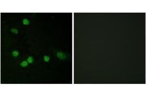 Immunofluorescence analysis of HeLa cells, using C-RAF (Ab-621) Antibody. (RAF1 Antikörper  (AA 591-640))