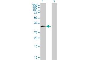 Western Blot analysis of ZNF215 expression in transfected 293T cell line by ZNF215 MaxPab polyclonal antibody. (ZNF215 Antikörper  (AA 1-304))
