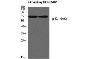 Western Blot (WB) analysis of Rat Kidney HepG2-UV using p-Ku-70 (S5) antibody. (XRCC6 Antikörper  (pSer5))