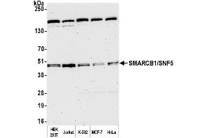 Western Blotting (WB) image for anti-SWI/SNF Related, Matrix Associated, Actin Dependent Regulator of Chromatin, Subfamily B, Member 1 (SMARCB1) (AA 75-125) antibody (ABIN7453587)