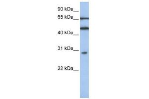 IFIT5 antibody used at 1 ug/ml to detect target protein. (IFIT5 Antikörper  (N-Term))