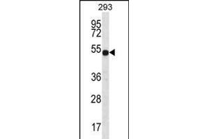 Western Blotting (WB) image for anti-ATPase, H+ Transporting, Lysosomal 56/58kDa, V1 Subunit B1 (ATP6V1B1) (AA 472-501), (C-Term) antibody (ABIN656224)