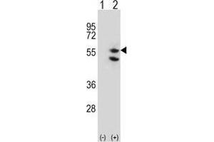 Western blot analysis of TUFM (arrow) using rabbit polyclonal TUFM Antibody (C-term) .