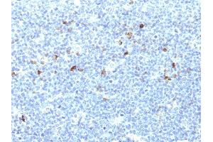 Formalin-fixed, paraffin-embedded human Tonsil stained with MHC I Monoclonal Antibody (CATA-1). (HLA-A Antikörper)