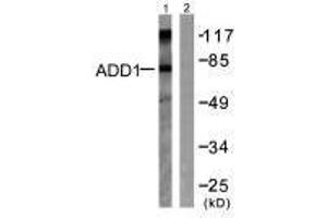 Western blot analysis of extracts from Hela cells treated with Forskolin (40nM, 30 min), using ADD1 (Ab-726) antibody. (alpha Adducin Antikörper  (Ser726))