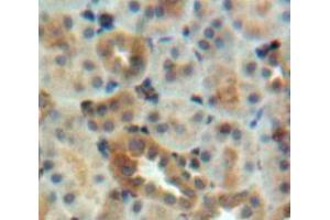 IHC-P analysis of kidney tissue, with DAB staining. (EEA1 Antikörper  (AA 1232-1348))