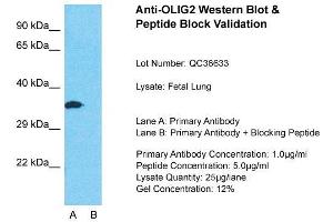 Host: Rabbit  Target Name: OLIG2  Sample Tissue: Fetal LungLane A:  Primary Antibody Lane B:  Primary Antibody + Blocking Peptide Primary Antibody Concentration: 1 µg/mL Peptide Concentration: 5 µg/mL Lysate Quantity: 41 µg/laneGel Concentration:.