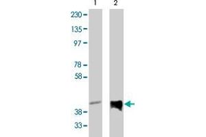 Western blot analysis using PPAP2C polyclonal antibody  on vector-controlled HEK293 cells (lane 1) and HEK293 cells overexpressing PPAP2C protein (lane 2) at 1 ug/mL .