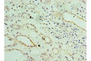 Immunohistochemistry of paraffin-embedded human kidney tissue using ABIN7143802 at dilution of 1:100 (ST8SIA2 Antikörper  (AA 24-160))