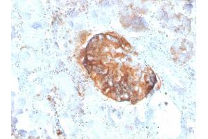 Formalin-fixed, paraffin-embedded human Kidney stained with MTAP Recombinant Mouse Monoclonal Antibody (rMTAP/1813).