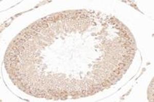 Immunohistochemistry analysis of paraffin-embedded rat testis using,NCKAP1 (ABIN7074784) at dilution of 1: 8000 (NCKAP1 Antikörper)