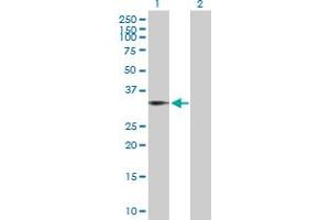 Western Blot analysis of BIN1 expression in transfected 293T cell line by BIN1 MaxPab polyclonal antibody. (BIN1 Antikörper  (AA 1-482))