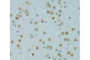 Immunohistochemistry of paraffin-embedded Rat brain using MUS81 Polyclonal Antibody at dilution of 1:100 (40x lens). (MUS81 Antikörper)