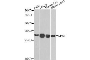 Western blot analysis of extracts of various cell lines, using RPS3 antibody (ABIN6290898) at 1:1000 dilution. (RPS3 Antikörper)