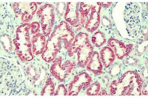 Human Kidney: Formalin-Fixed, Paraffin-Embedded (FFPE) (ANTXR2 Antikörper  (AA 121-133))