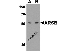 Western Blotting (WB) image for anti-Arylsulfatase B (ARSB) (C-Term) antibody (ABIN2457880) (Arylsulfatase B Antikörper  (C-Term))