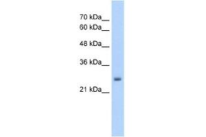 Western Blotting (WB) image for anti-NMDA Receptor Synaptonuclear Signaling and Neuronal Migration Factor (NSMF) (Middle Region) antibody (ABIN2775422)