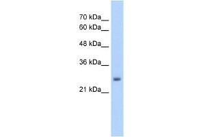 WB Suggested Anti-NELF Antibody Titration:  5.