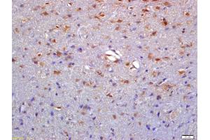 Formalin-fixed and paraffin embedded rat brain labeled with Anti-NTR1/Neurotensin Receptor 1 Polyclonal Antibody, Unconjugated (ABIN1386649) at 1:200 followed by conjugation to the secondary antibody and DAB staining