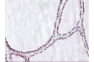 Immunohistochemical staining of paraffin-embedded Human thyroid tissue using anti-HES1 mouse monoclonal antibody. (HES1 Antikörper)
